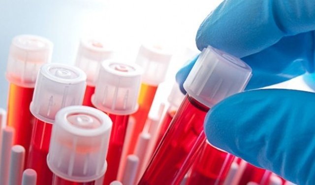 İş başvurularında uyuşturucu testi dönemi başlıyor!