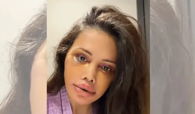 Didem Ceran Kimdir? Eşi kimdir? Oğlu kimdir? Neden yüz nakli yaptırdı?