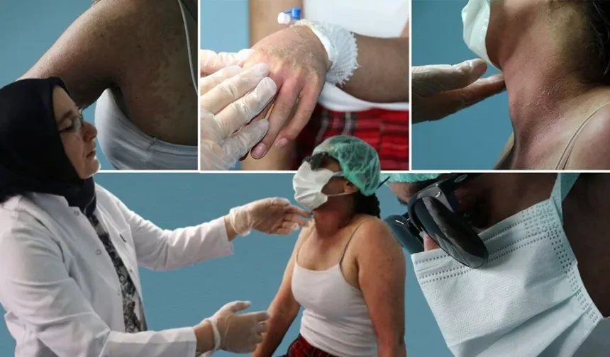 Sosyal medyadan aldığı krem yoğun bakıma soktu: İçindeki madde doktoru bile şok etti!