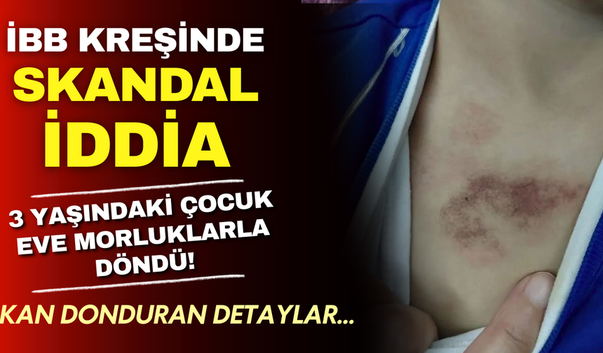 İBB kreşinde skandal iddia: 3 yaşındaki çocuk eve morluklarla döndü!