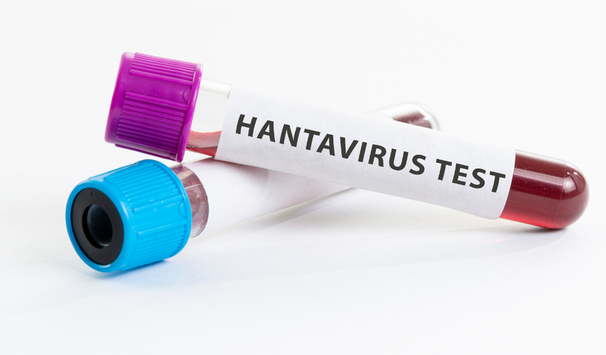 Uzmanından Hantavirüs uyarısı!