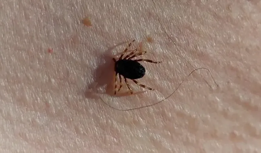 Uzmanından kene uyarısı! Bu yöntemleri asla kullanmayın